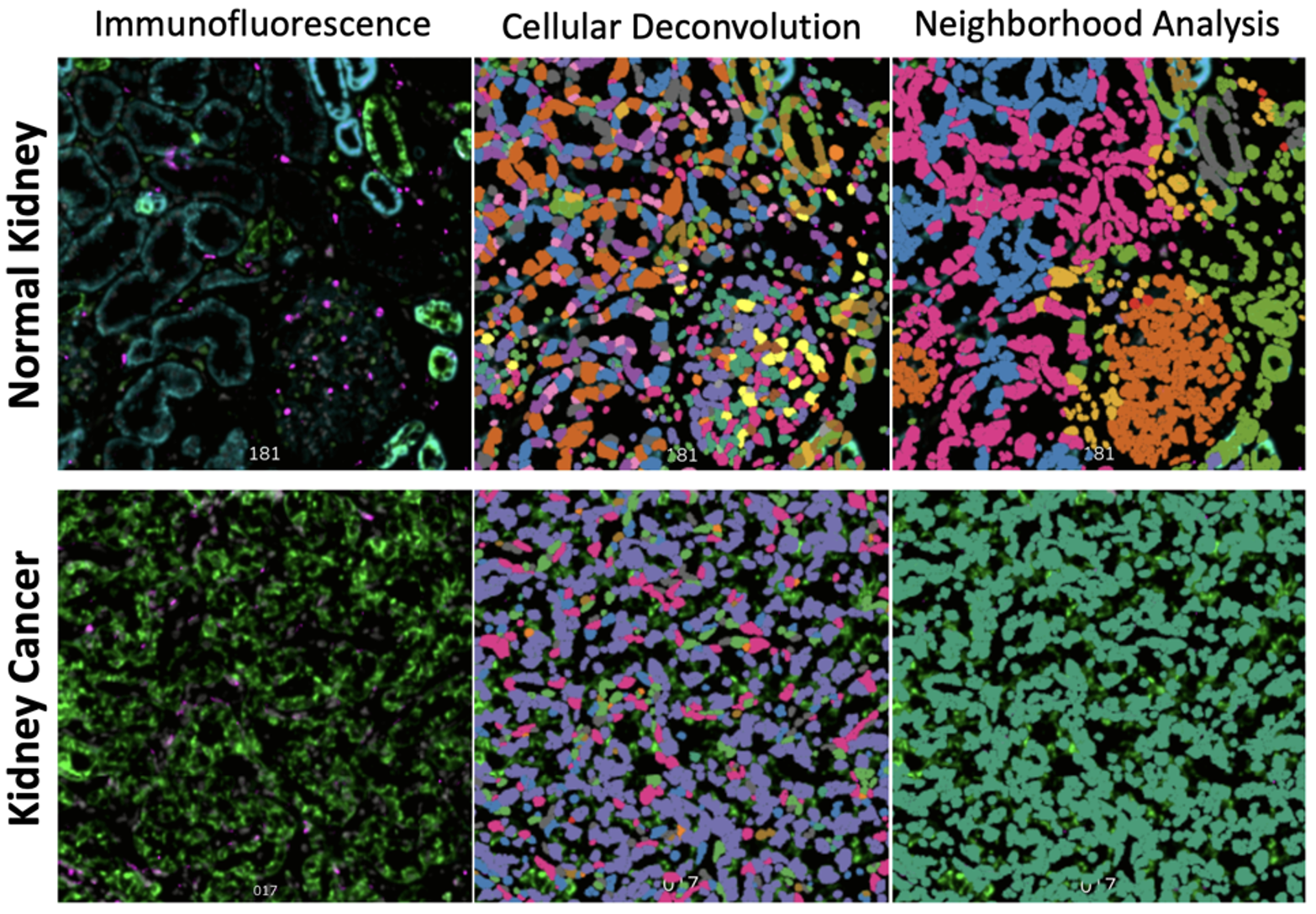 Example of the Core's 1000-plex gene expression profiling with single-cell resolution on the CosMx SMI.